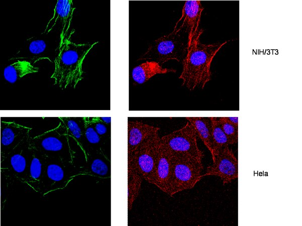 ANTI- ACTIN, NEAR A.A. 50-70, CLONE C4.ALL SPECIES APLICATIONS: ELISA,WB,IC,IH, IH (P). HOST: MOUSE QTY/PK 100UG