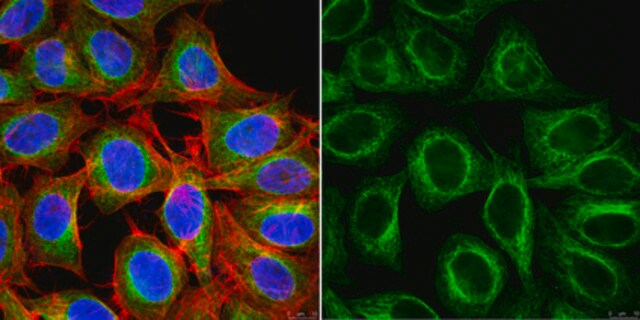 ANTI-?-TUBULIN, CLONE AA2; 200 µg MILLIPORE