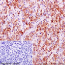 ANTICUERPO ABCAM ANTI-BCL-2 [E17] CONEJO MONOCLONAL. RECONOCE A BCL-2. REACCIONA CON RATON Y HUMANO, NO REACCIONA CON RATA. PRESENTACION: LIQUIDO 100 UL.