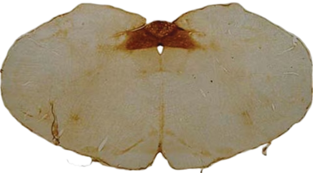 ANTICUERPO ANTI ACIDO POLISIALICO NCAM, CLON 2-2B. CANTIDAD: 50 µL. MARCA MERCKMILLIPORE