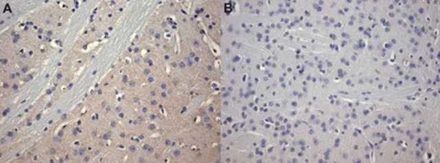 ANTICUERPO ANTI RECEPTOR A2A ADENOSINA, CLONE 7F6-G5-A2. HUESPED. RATON. 200 µg