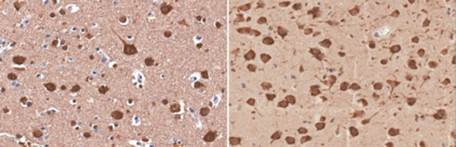 ANTICUERPO ANTI-LC3B MERCK MILLIPORE 15KDA.REACTIVIDAD EN HUMANO. CANTIDAD 100 UL POR PAQUETE. FORMATO:SUERO. HUESPED: CONEJO. PEPTIDO LINEAR QUE CORRESPONDE A HUMANO LC3B.