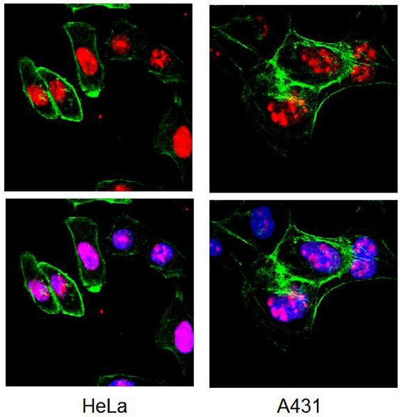 SIGMA-ALDRICH ANTICUERPO ANTI-KI-67, MONONCLONAL PURIFICADO DE RATÓN, VALIDADO PARA USO EN CF, ICQ, IHQ, IHQ(P) Y WB - 100µG