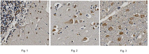 SIGMA-ALDRICH ANTICUERPO ANTI-RECEPTOR NEURONAL DE ACETILCOLINA ?-7, CLON 6F12.2, PURIFICADO, VALIDADO PARA WB, IHQ - 100µG