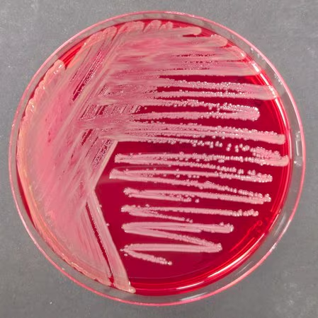 BURKHOLDERIA CEPACIA SELECTIVE AGAR