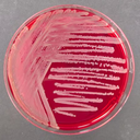 BURKHOLDERIA CEPACIA SELECTIVE AGAR