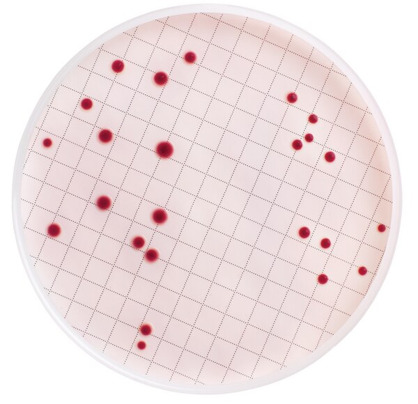 MEDIO DE CULTIVO MF-ENDO DESHIDRATADO PARA RECUENTO DE COLIFORMES TOTALES. FRASCO/100 Gramos.