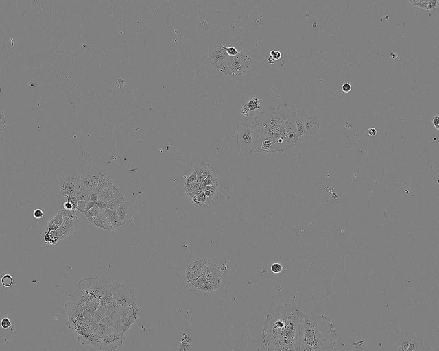 Sulfur PESTANAL®, analytical standardCACO-2 CELL LINE HUMAN FROM HUMAN COLON(CAUCADENOCARCINOMA) 1 VIAL