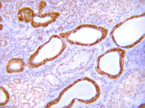 Anti-GLUT-4 Antibody, C-terminus. 100 uL.