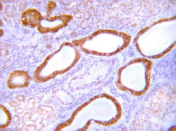Anti-GLUT-4 Antibody, C-terminus. 100 uL.