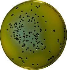 HEKTOEN ENTERIC AGAR - MEDIO MODERADAMENTE SELECTIVO Y DE DIFERENCIACIÓN PARA EL AISLAMIENTO Y EL CULTIVO DE MICROORGANISMOS GRAM NEGATIVOS ENTÉRICOS