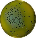 HEKTOEN ENTERIC AGAR - MEDIO MODERADAMENTE SELECTIVO Y DE DIFERENCIACIÓN PARA EL AISLAMIENTO Y EL CULTIVO DE MICROORGANISMOS GRAM NEGATIVOS ENTÉRICOS