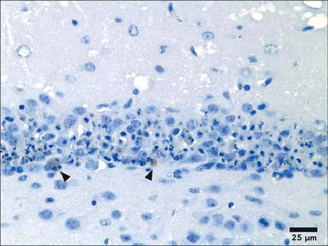 ANTICUERPO ANTI- CASPASA 3 FORMA ACTIVA MERCK MILLIPORE CHEMICON 17 KDA. CANTIDAD 50 UG. HUESPED: CONEJO. ANTICUERPO POLICLONAL