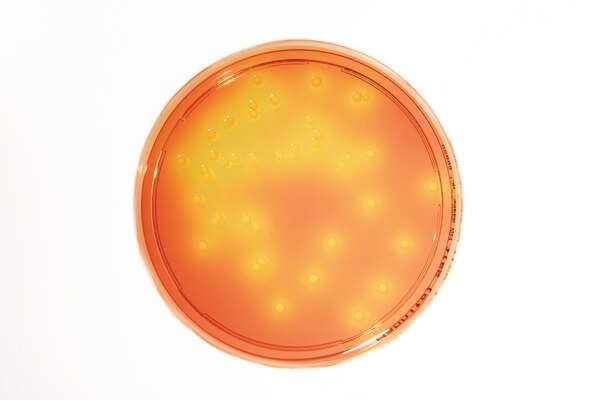 AGAR MANITOL SALADO - LI 30 ml. IDENTIFICACION Staphylococcus aureus. 20 PC