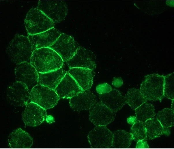 ANTICUERPO ANTI RECEPTOR ACETYLCOLINA MUSCARINICO M3. HUESPED CONEJO. 50 µl