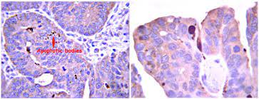 ANTI-CASPASE-6 (PRO), CLONE EP1325Y, RABBIT MONOCLONAL, 1 DE QTY/PK: 100 µL