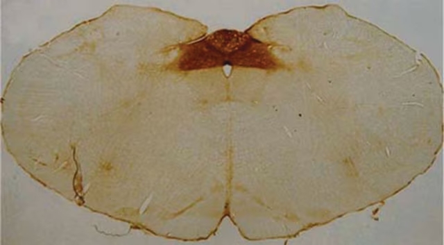 ANTICUERPO ANTI ACIDO POLISIALICO NCAM, CLON 2-2B. CANTIDAD: 50 µL. MARCA MERCKMILLIPORE