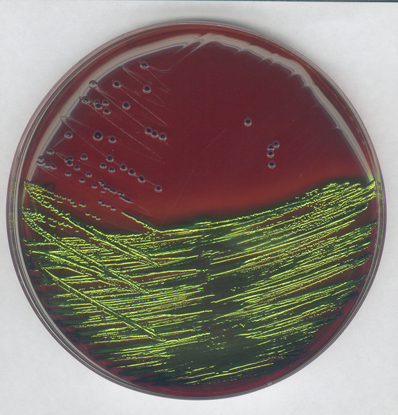 AGAR EMB PARA DETECCION Y AISLAMIENTO DE ENTEROBACTERIAS PATOGENAS. CANTIDAD 500 GRAMOS. MARCA MERCK