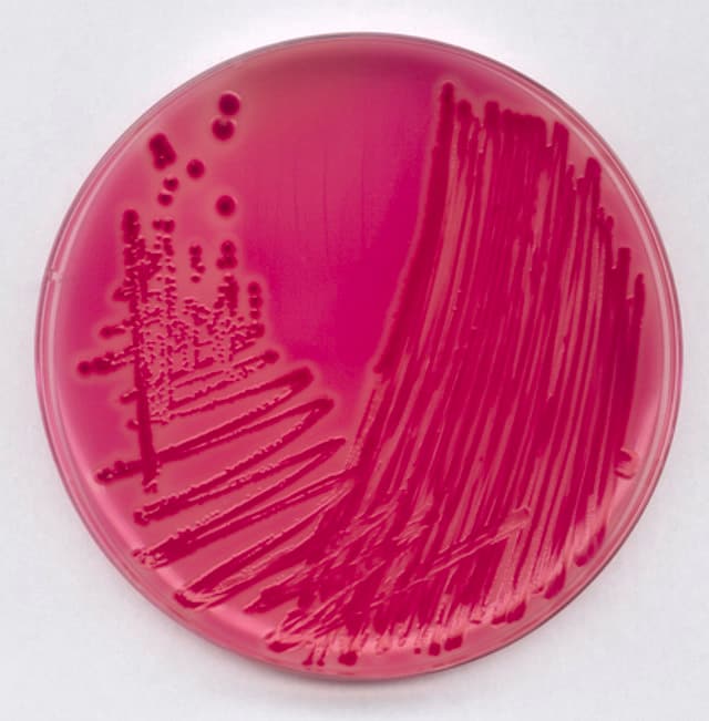 RAMBACH AGAR PARA LA IDENTIFICACION DE SALMONELLA. CANTIDAD: 1 SET. MARCA MERCK