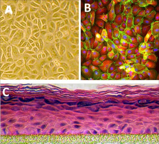 QUERATINOCITOS EPIDERMICOS HUMANOS: HEK, ADULTO