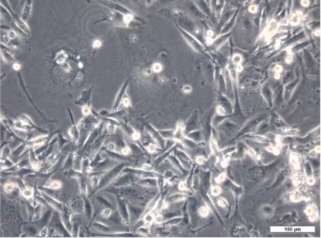 LINEA CELULAR MDA-MB-231 (HUMAN BREAST ADENOCARCINOMA) 1 VIAL