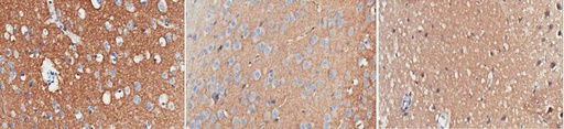 [MABN894] SIGMA-ALDRICH ANTICUERPO ANTI-SINAPSINA-1, CLON 10.22, SINAPSINA-1 PURIFICADA DE CEREBRO BOVINO, VALIDADO PARA WB, IH(P), IP, IF - 100µG