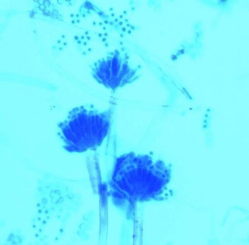 [1137410100] AZUL LACTOFENOL EN SOLUCIÒN TINCION HONGOS 100 ml