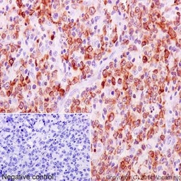 [AB32124] ANTICUERPO ABCAM ANTI-BCL-2 [E17] CONEJO MONOCLONAL. RECONOCE A BCL-2. REACCIONA CON RATON Y HUMANO, NO REACCIONA CON RATA. PRESENTACION: LIQUIDO 100 UL.
