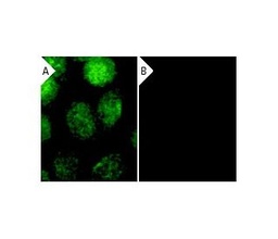 [SC-29435] ANTICUERPO P53 siRNA (h) SANTA CRUZ BIOTECNOLOGY. CANTIDAD 10 UM