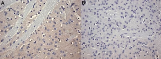 [05-717] ANTICUERPO ANTI RECEPTOR A2A ADENOSINA, CLONE 7F6-G5-A2. HUESPED. RATON. 200 µg