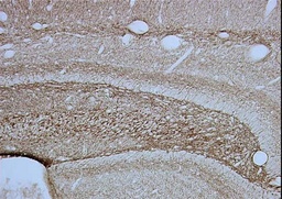 [MAB5262] ANTICUERPO ANTI NEUROFILAMENTO 2OO kDA, CLON R798. CANTIDAD: 50 µg. MARCA MERCKMILLIPORE