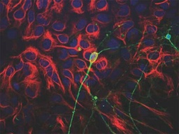 [AB9354] ANTICUERPO ANTI BETA III TUBULINA. CANTIDAD: 500 µL. MARCA MERCKMILLIPORE