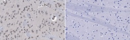 [ABE457] ANTICUERPO ANTI C-FOS. CANTIDAD: 100 µg. MARCA: MERCKMILLIPORE