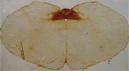 [MAB5324] ANTICUERPO ANTI ACIDO POLISIALICO NCAM, CLON 2-2B. CANTIDAD: 50 µL. MARCA MERCKMILLIPORE