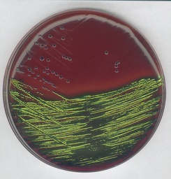 [1013470500] AGAR EMB PARA DETECCION Y AISLAMIENTO DE ENTEROBACTERIAS PATOGENAS. CANTIDAD 500 GRAMOS. MARCA MERCK
