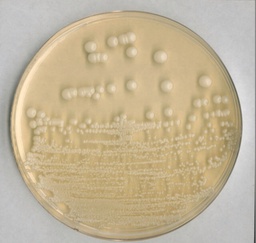 [1054670500] AGAR SELECTIVO PARA HONGOS PATOGENOS PARA AISLAMIENTO DE HONGOSPATOGENOS (CONTIENE CICLOHEXIMIDA. CANTIDAD 500 GRAMOS. MARCA MERCK